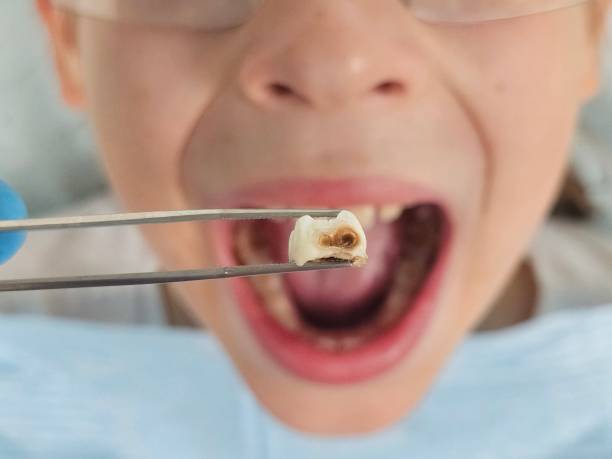 Best Emergency Treatment for Toothache in Canfield, OH